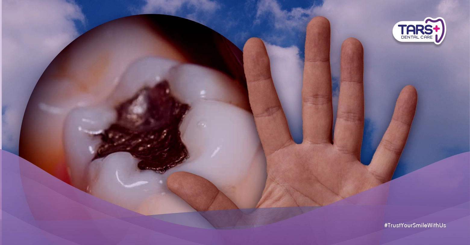 Tambal Gigi: 5 Tanda Gigi Kamu Harus Segera Ditangani Dokter