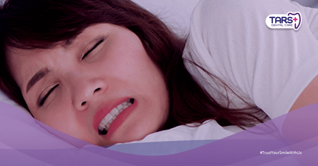 Bruxism: Gigi Bunyi ‘Krek-Krek’ Saat Tidur Bisa Jadi Tanda Bahaya yang Menghancurkan Permanen