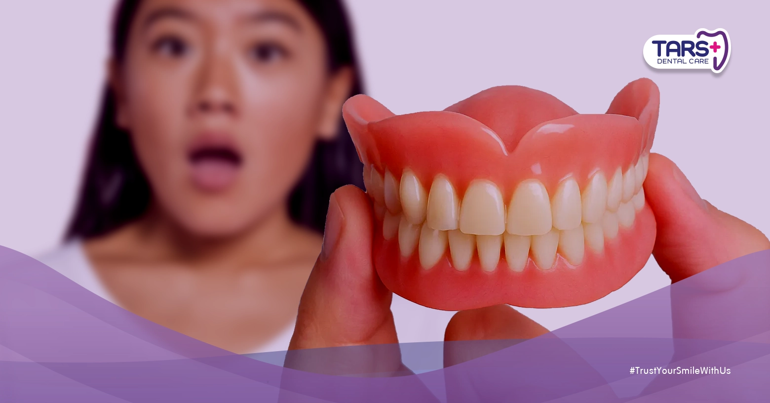 Gigi Bisa Bikin Stroke, Ini Penjelasan Medisnya