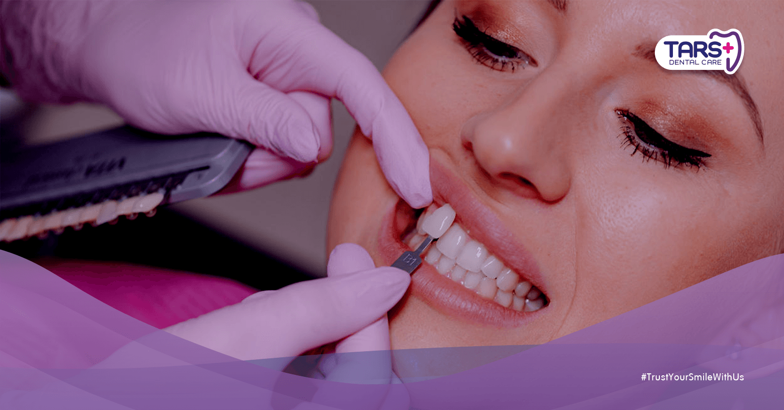 Bruxism: Gigi Bunyi ‘Krek-Krek’ Saat Tidur Bisa Jadi Tanda Bahaya yang Menghancurkan Permanen