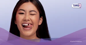 Apakah Cabut Gigi Selalu Butuh Gigi Pengganti? 7 Fakta Penting yang Perlu Kamu Tahu