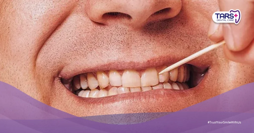 Bahaya Menggunakan Tusuk Gigi Terlalu Sering