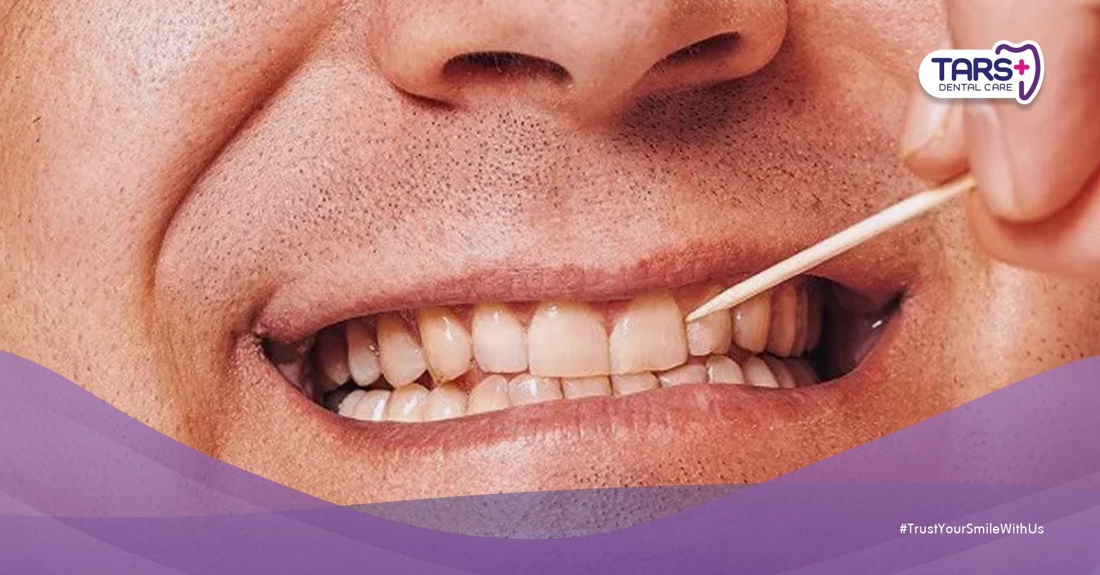 Bahaya Menggunakan Tusuk Gigi Terlalu Sering