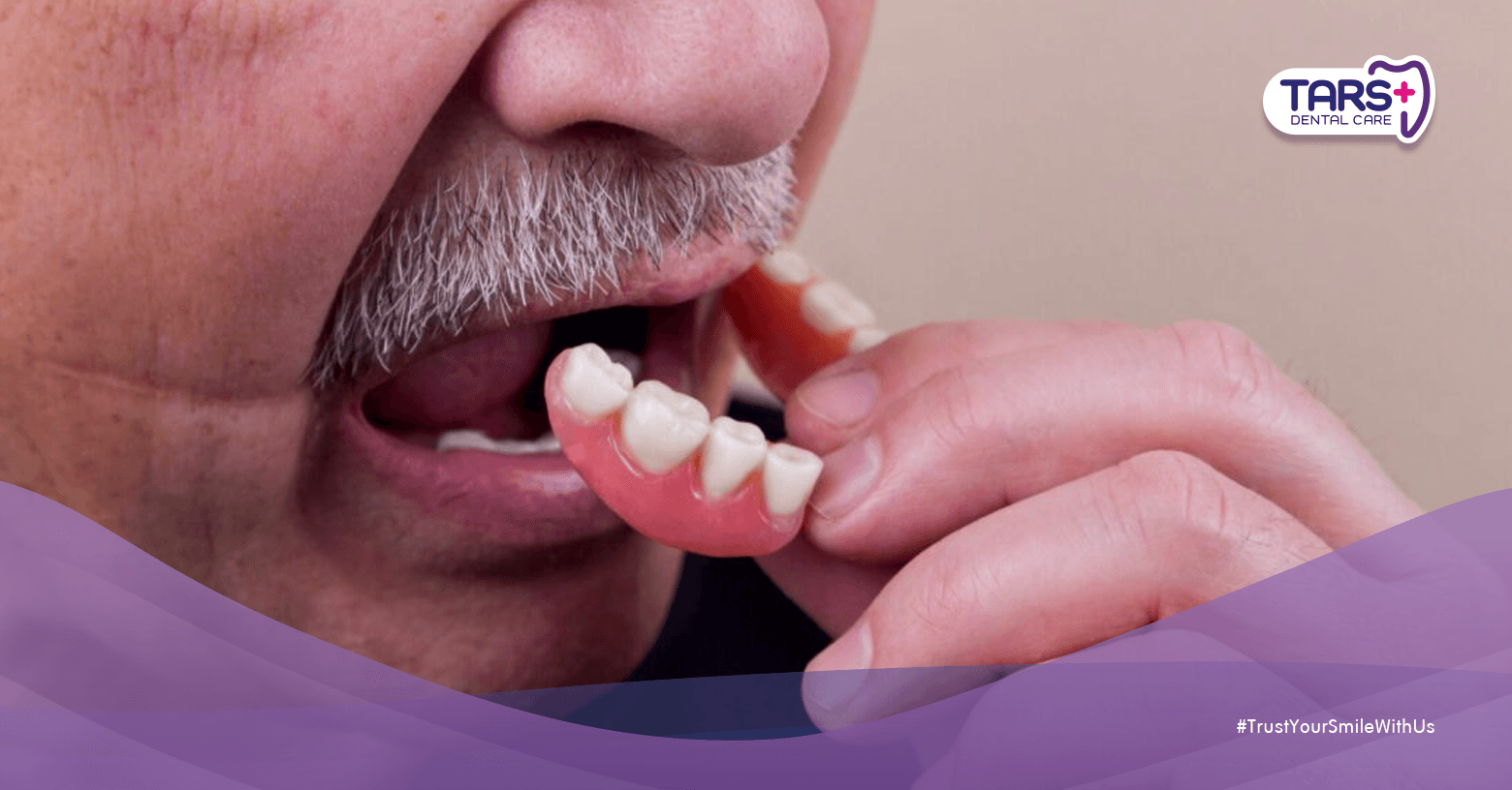 7 Cara Merawat Gigi Palsu untuk Lansia agar Tetap Nyaman dan Awet