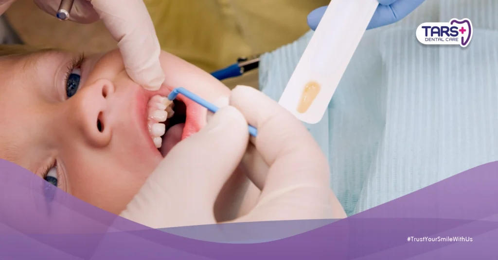 Fluoride untuk Anak: Manfaat dan Risikonya yang Wajib Orang Tua Pahami