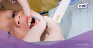 Fluoride untuk Anak: Manfaat dan Risikonya yang Wajib Orang Tua Pahami