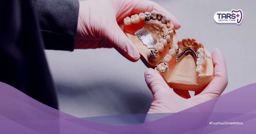 5 Fakta tentang Gigi Palsu: Apakah Benar Bisa Bertahan Seumur Hidup?