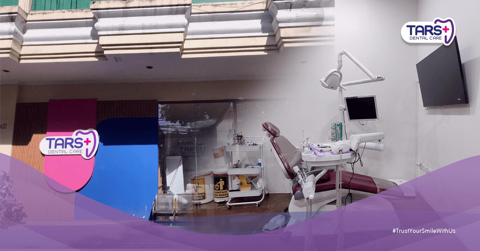 Butuh Klinik Gigi Terdekat di Jakarta Selatan? Cek TARS Dental Care Setiabudi