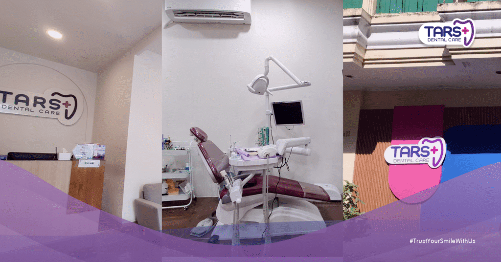 TARS Dental Care Setiabudi: Klinik Gigi Keluarga Modern & Terpercaya di Jakarta Selatan