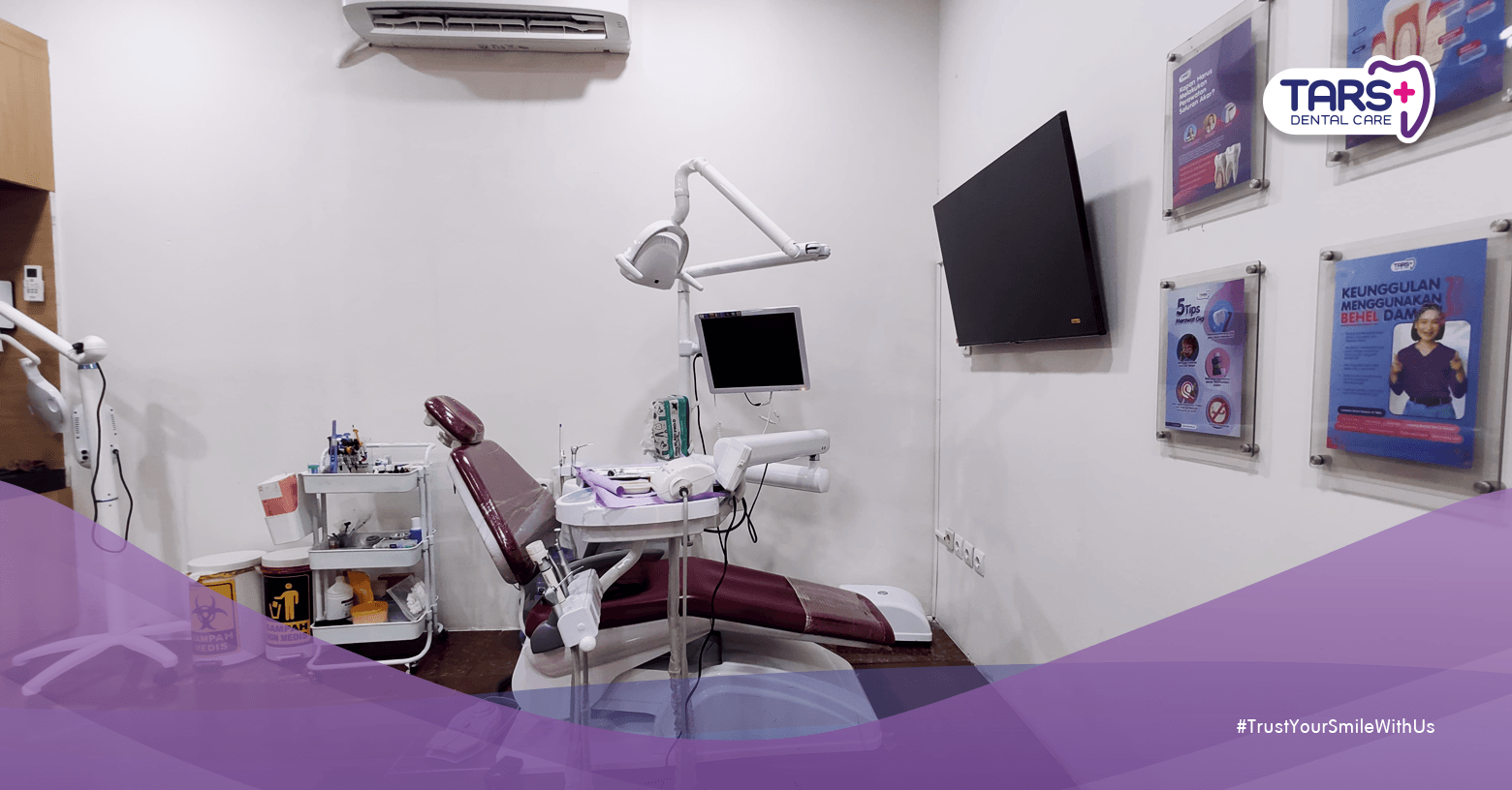 Pengalaman Perawatan Gigi di TARS Dental Care Setiabudi, Jakarta Selatan