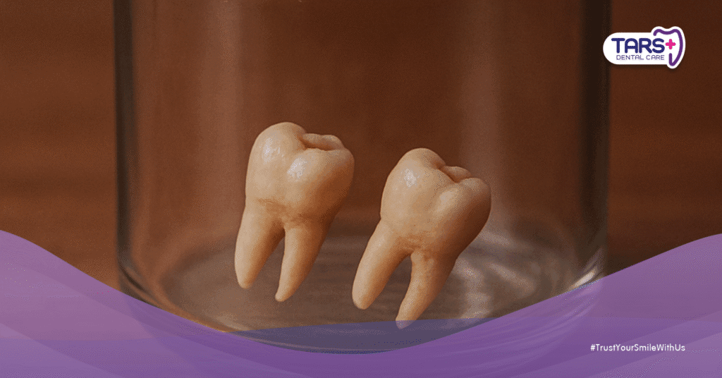 Gigi Susu Ternyata Bisa Disimpan untuk Masa Depan, Bukan Cuma Buat Kenang-Kenangan!