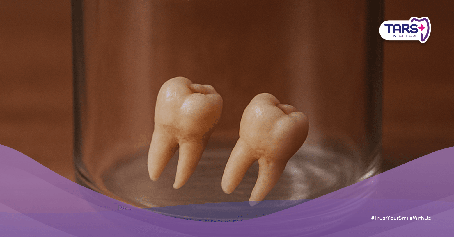 Gigi Susu Ternyata Bisa Disimpan untuk Masa Depan, Bukan Cuma Buat Kenang-Kenangan!