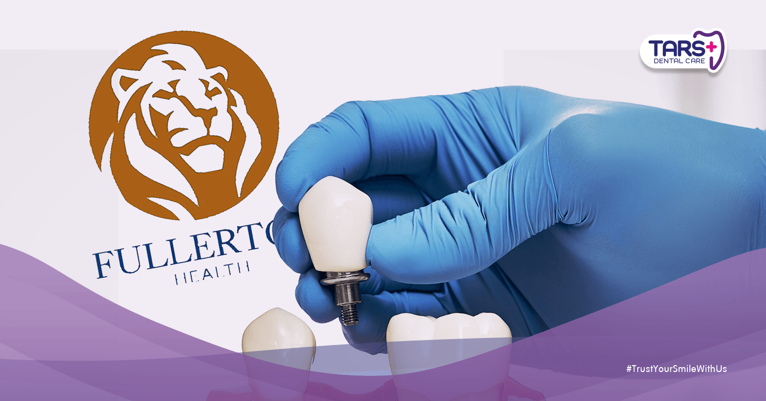 TARS Dental Care Resmi Jadi Klinik Gigi Rekanan Fullerton: Perawatan Gigi Kini Lebih Mudah dengan Asuransi