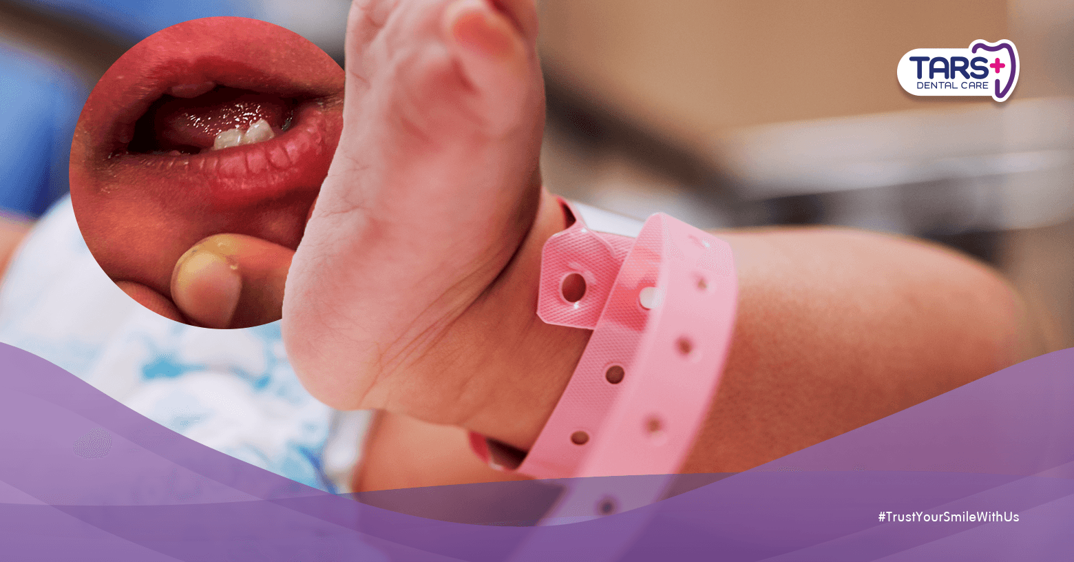 Bayi Lahir Sudah Punya Gigi? Ini Penyebab & Bahayanya yang Wajib Diwaspadai!