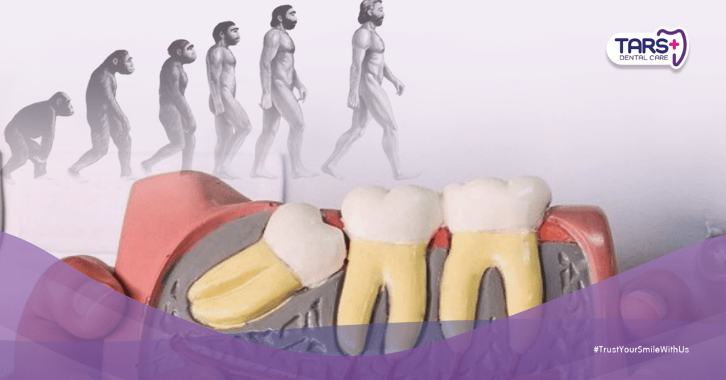 Gigi Bungsu Itu ‘Warisan’ dari Manusia Purba yang Makan Daging Mentah — Sekarang Jadi Masalah!