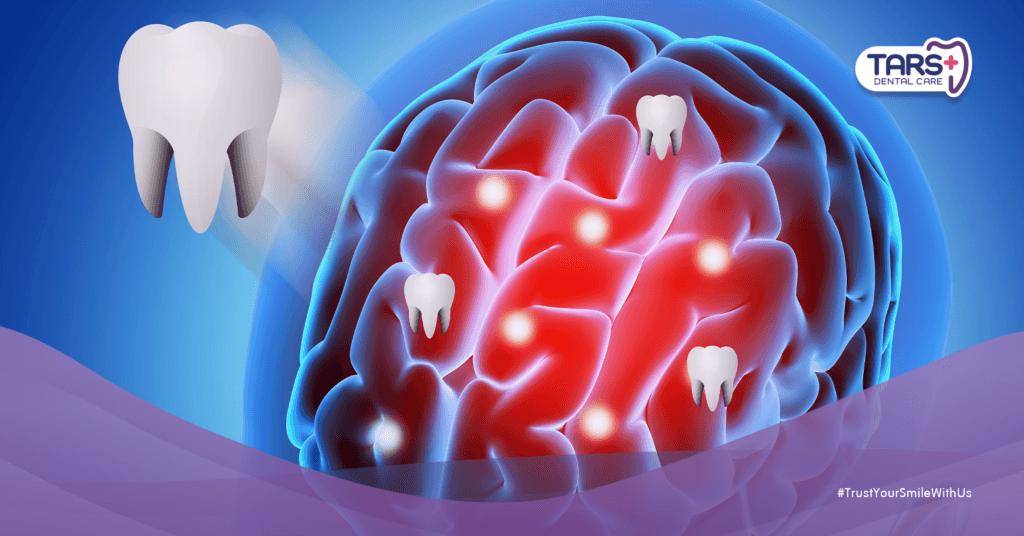 Teratoma Kranial, Kondisi Langka di Balik Fenomena Gigi yang Tumbuh di Otak