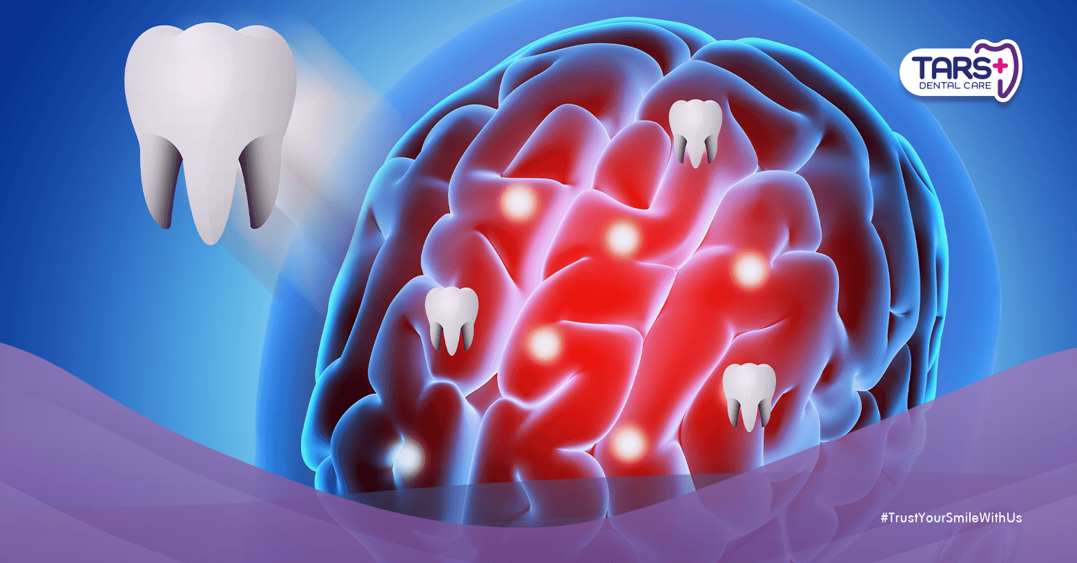 Teratoma Kranial, Kondisi Langka di Balik Fenomena Gigi yang Tumbuh di Otak