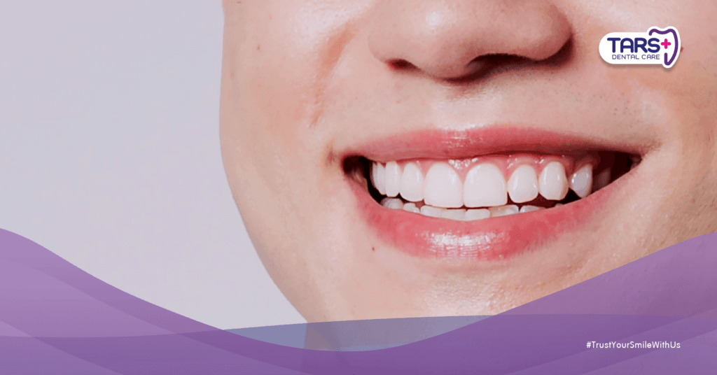 Gigi Kuning Belum Tentu Kotor — Ini Arti Warna Gigi Asli Kamu