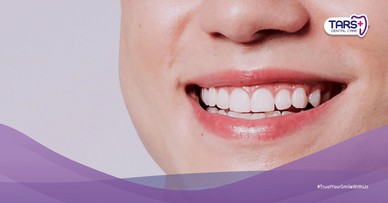 Gigi Kuning Belum Tentu Kotor — Ini Arti Warna Gigi Asli Kamu