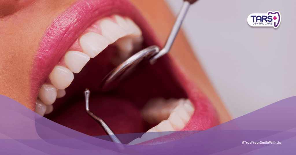 10 Tips Perawatan Gigi Sebelum Ramadhan untuk Puasa Nyaman Tanpa Sakit