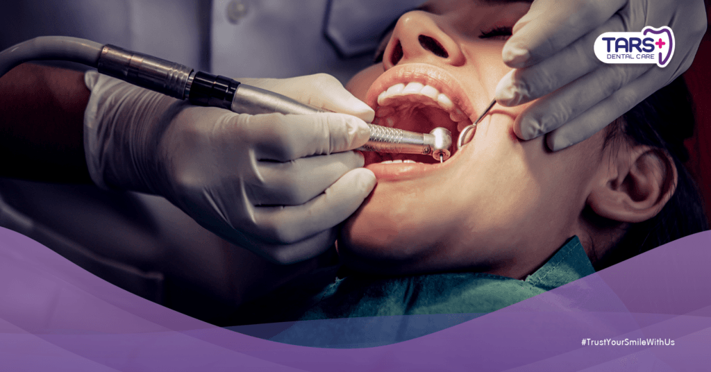 7 Kesalahan Perawatan Gigi yang Bikin Puasa Susah – Hindari saat Ramadhan