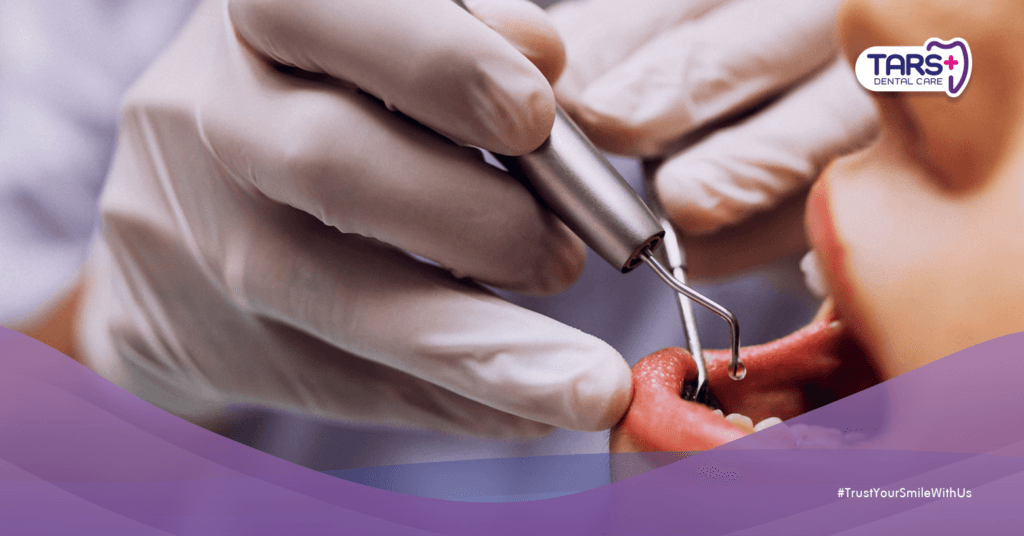 Perawatan Gigi Pra-Ramadhan: 7 Cara Cegah Bau Mulut & Sakit Gigi Saat Puasa