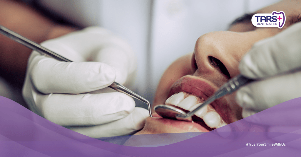 Perawatan Gigi dan Mulut Optimal saat Ramadhan untuk Kesehatan Maksimal