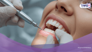 Biaya Scaling Gigi: Manfaat, Prosedur, dan Kisaran Harga Lengkap