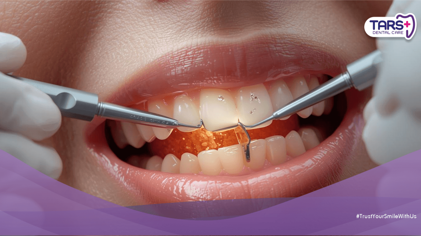 Scaling Gigi: Manfaat, Prosedur, dan Kenapa Harus Rutin Dilakukan