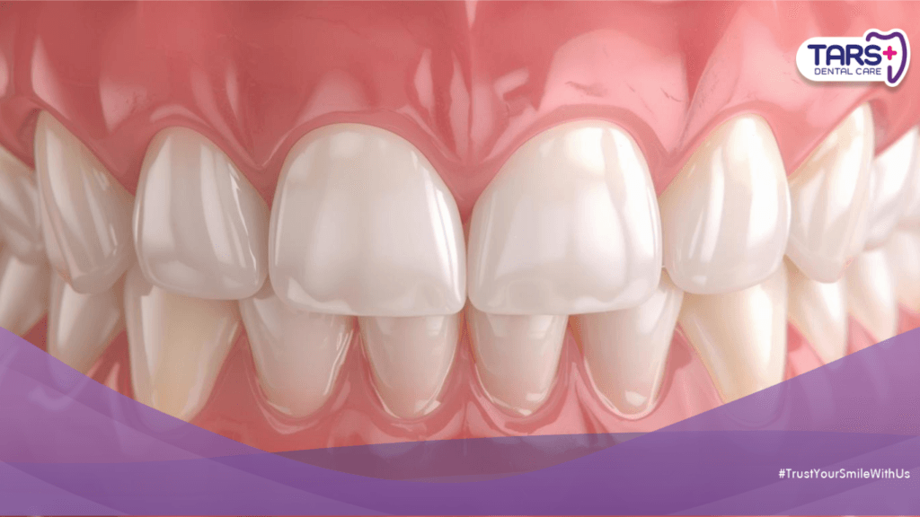 Gusi Berdarah Saat Puasa? Ketahui Penyebab dan Solusinya